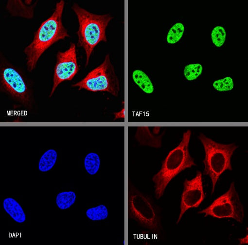 TAF15 Recombinant Rabbit mAb (S-1508-53)
