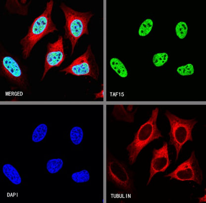 TAF15 Recombinant Rabbit mAb (S-1508-53)