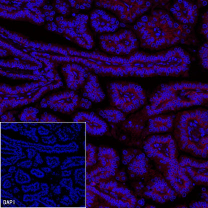 EpCAM Recombinant Rabbit mAb (PE Conjugate) (S-078-13)
