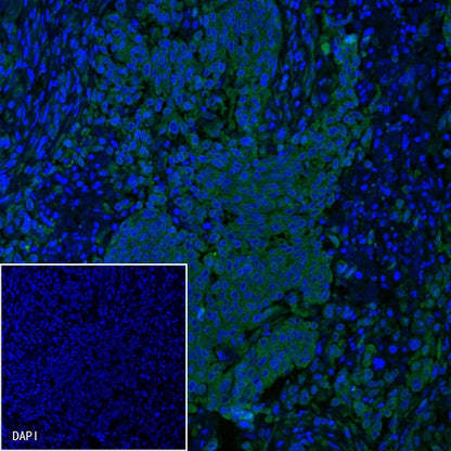 PD-L1 Recombinant Rabbit mAb (Alexa Fluor® 488 Conjugate) (S-119-16)