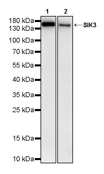 SIK3 Rabbit Polyclonal Antibody