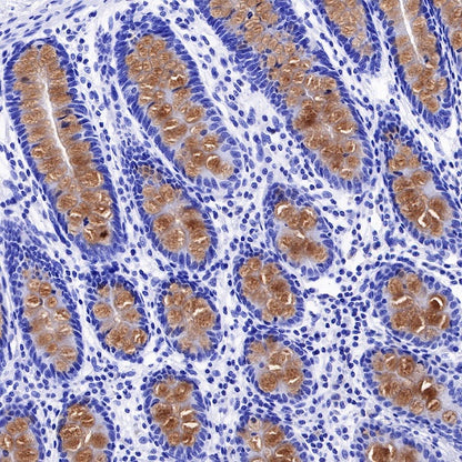 MUC2 Recombinant Rabbit mAb (SDT-345-9)