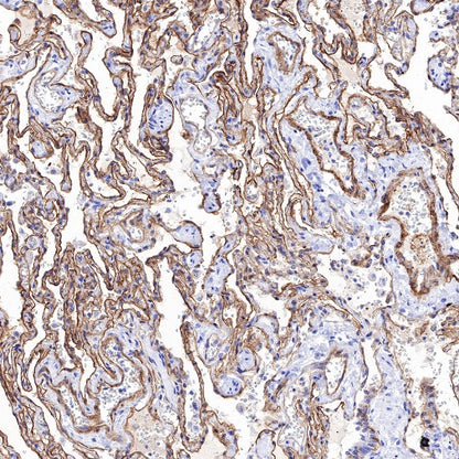 CD239 Recombinant Rabbit mAb (S-683-3)
