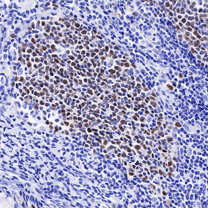 CHAF1b Recombinant Rabbit mAb (S-R316)