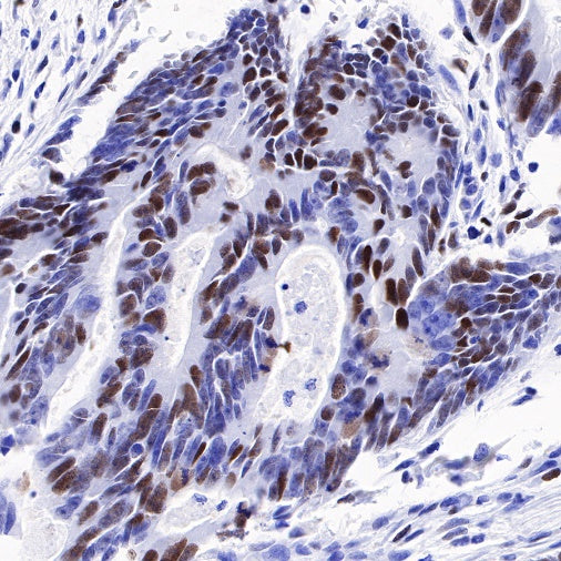 CHAF1b Recombinant Rabbit mAb (S-R316)