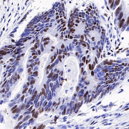 CHAF1b Recombinant Rabbit mAb (S-R316)