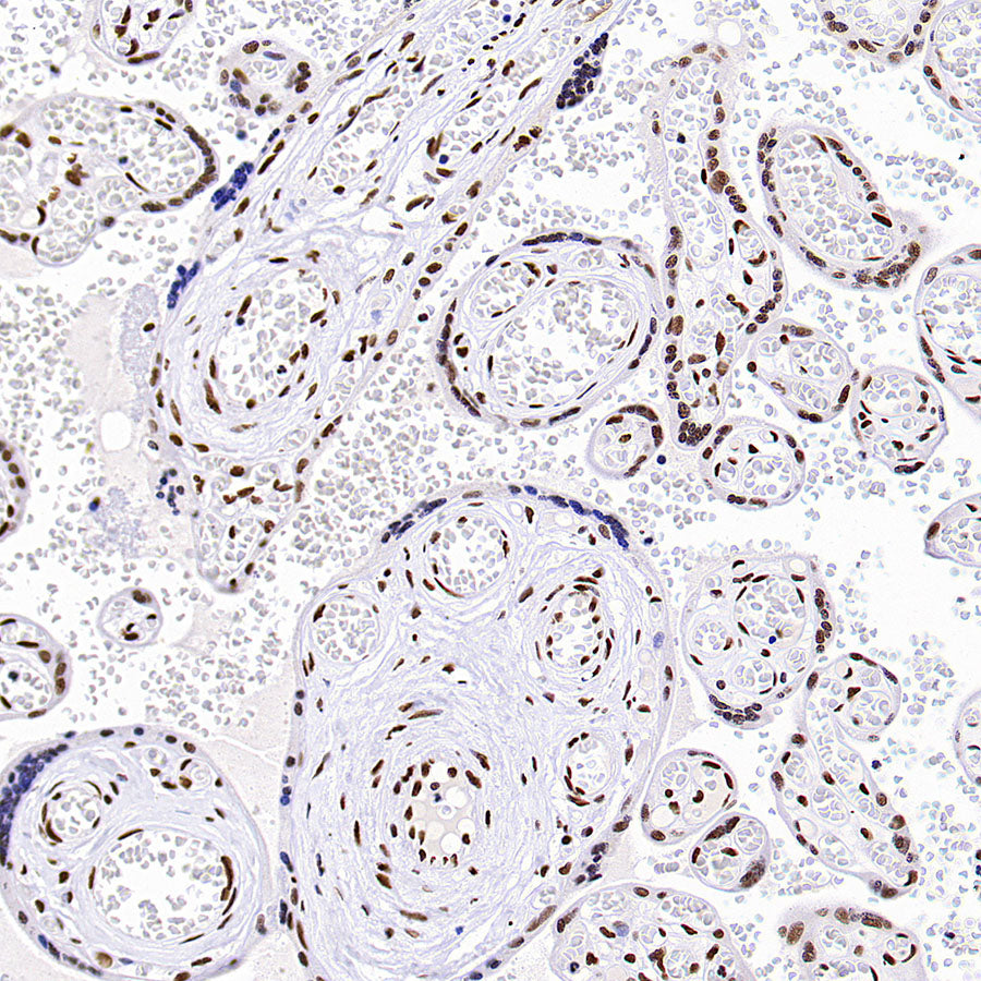 TriMethyl-Histone H3 (K36) Recombinant Rabbit mAb (S-M0025)