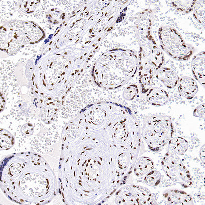 TriMethyl-Histone H3 (K36) Recombinant Rabbit mAb (S-M0025)