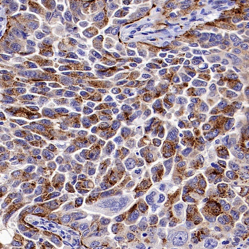 PSEN2 Recombinant Rabbit mAb (S-2084-14)