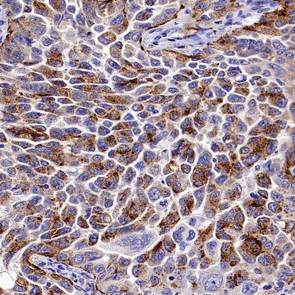 PSEN2 Recombinant Rabbit mAb (S-2084-14)