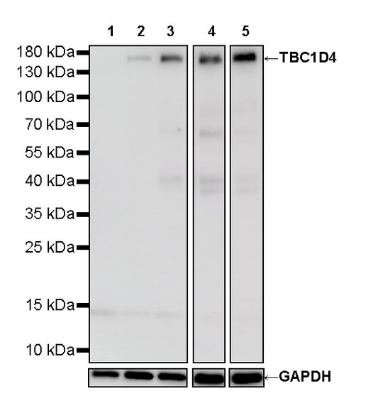 TBC1D4 Recombinant Rabbit mAb (S-4328-80)