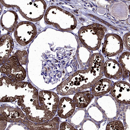 AGTR1 Recombinant Rabbit mAb (S-2447-22)