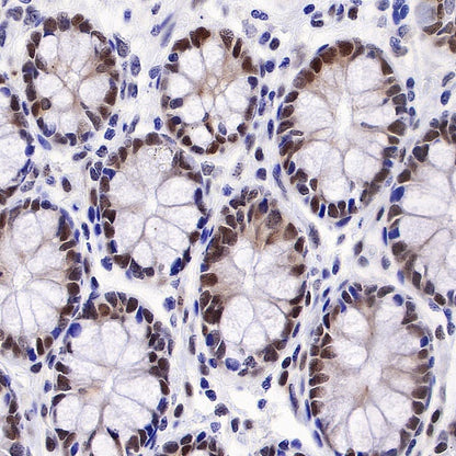 APE Recombinant Rabbit mAb (S-R349)