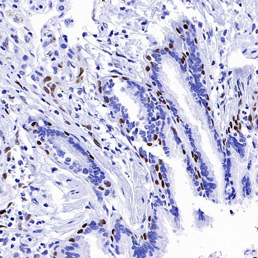 IL-33 Recombinant Rabbit mAb (S-1700-223)