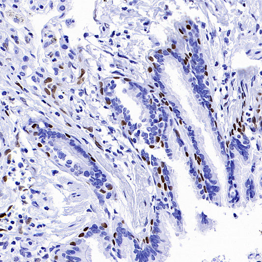 IL-33 Recombinant Rabbit mAb (S-1700-223)
