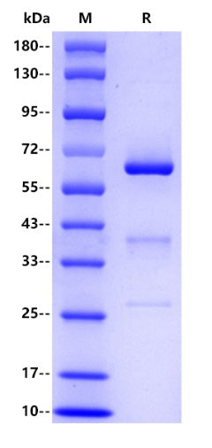 Human CD73, His tag