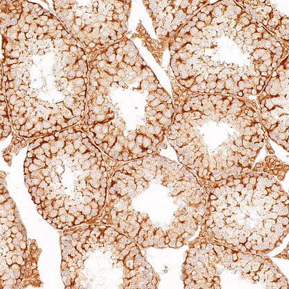 p58IPK/DNAJC3 Recombinant Rabbit mAb (S-4816-205)