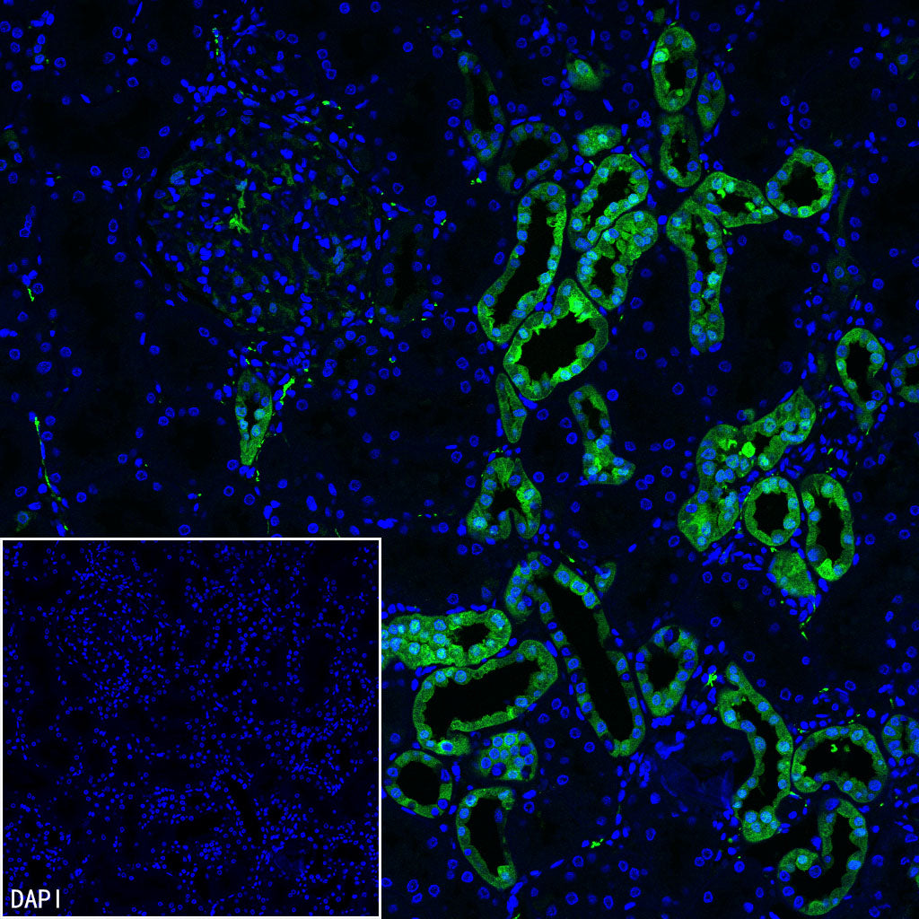 PGP9.5 Recombinant Mouse mAb (S-6071)
