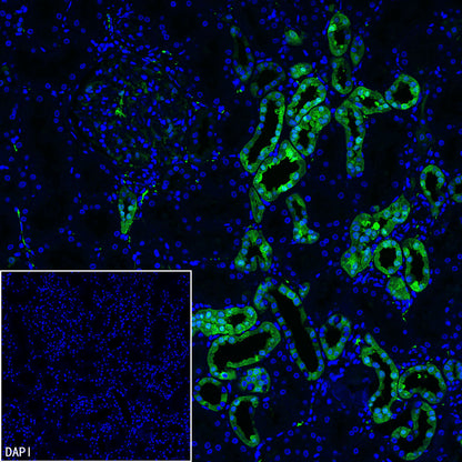 PGP9.5 Recombinant Mouse mAb (S-6071)