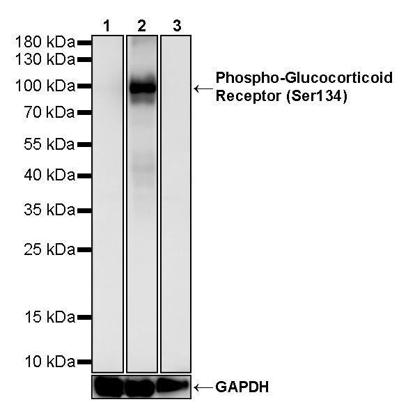Phospho-Glucocorticoid Receptor (Ser134) Recombinant Rabbit mAb (S-5295)