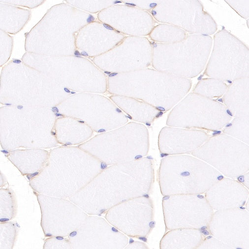 Dystrophin Recombinant Rabbit mAb (S-090-327)