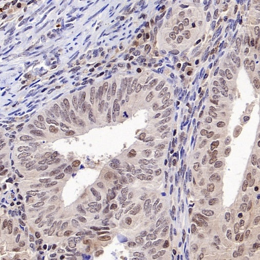 PSME4 Recombinant Rabbit mAb (S-3132-44)