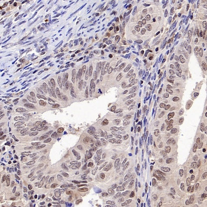 PSME4 Recombinant Rabbit mAb (S-3132-44)