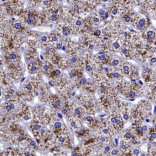 Optineurin Recombinant Rabbit mAb (S-2030-40)
