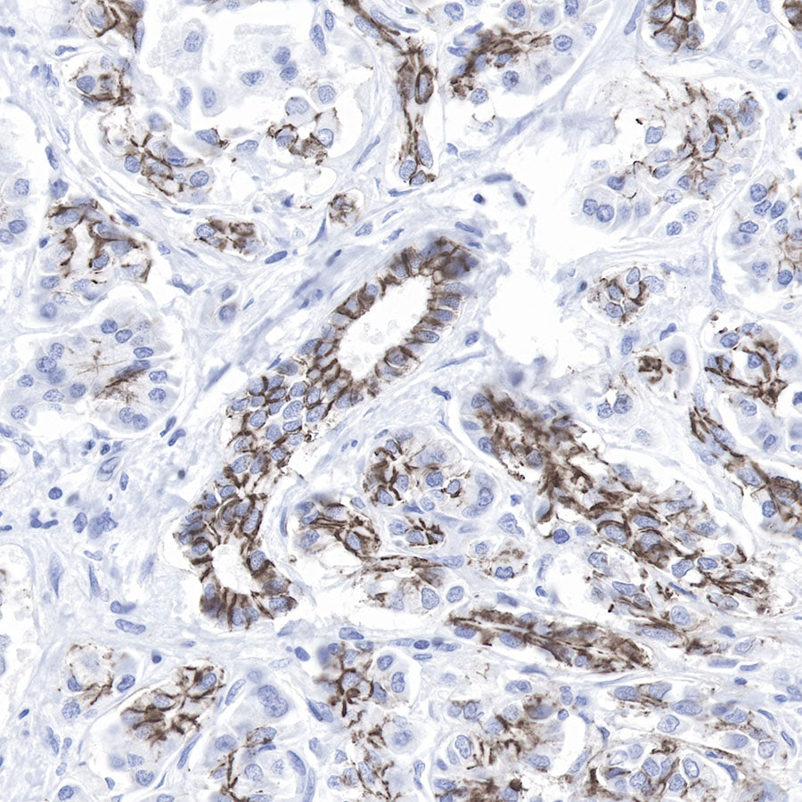 Claudin-1 Recombinant Rabbit mAb,PBS Only (SDT-R024)