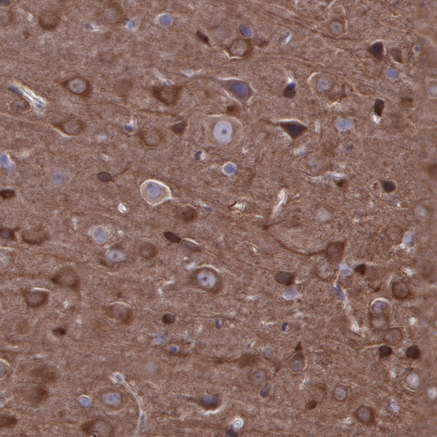 Stathmin 1 Recombinant Rabbit mAb (SDT-383-4)