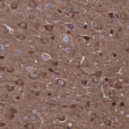 Stathmin 1 Recombinant Rabbit mAb (SDT-383-4)