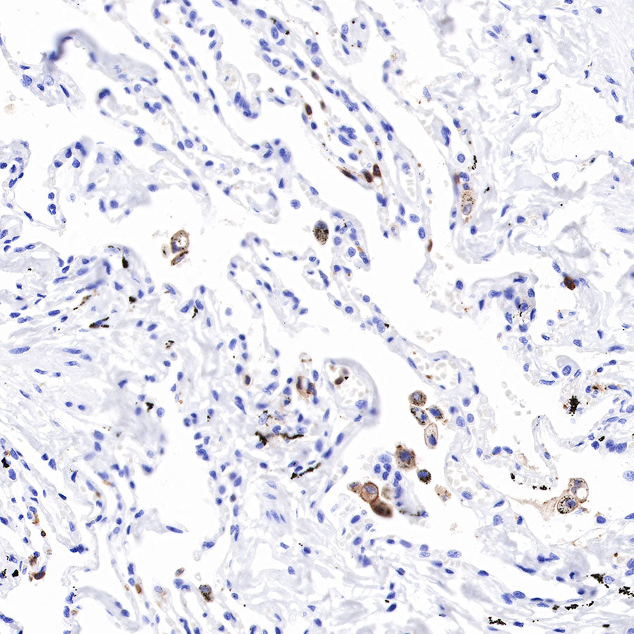 S-RMab® CD16a Recombinant Rabbit mAb (SDT-R099)