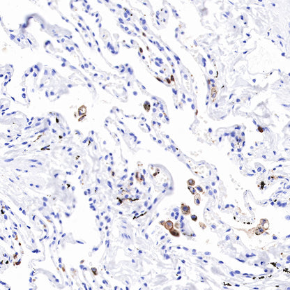 S-RMab® CD16a Recombinant Rabbit mAb (SDT-R099)