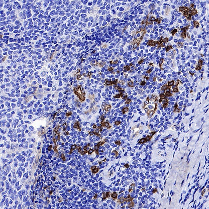 CD123 Recombinant Rabbit mAb (S-1592-12)