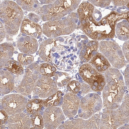 Acetyl-CoA Carboxylase Recombinant Rabbit mAb (S-2220-96)