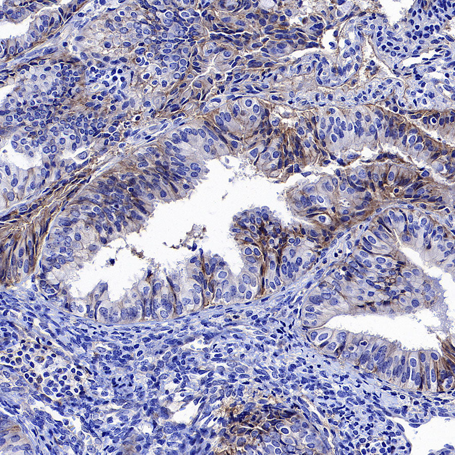 CD151 Recombinant Rabbit mAb (S-3235-104)