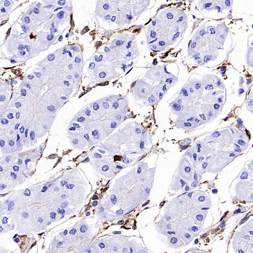 FAP Recombinant Rabbit mAb (S-3094-29)