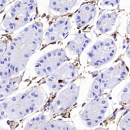FAP Recombinant Rabbit mAb (S-3094-29)