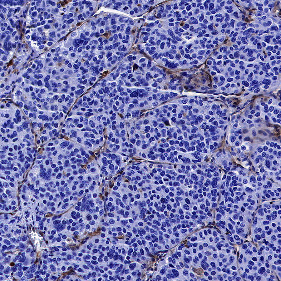 ADA Recombinant Rabbit mAb (S-5470)