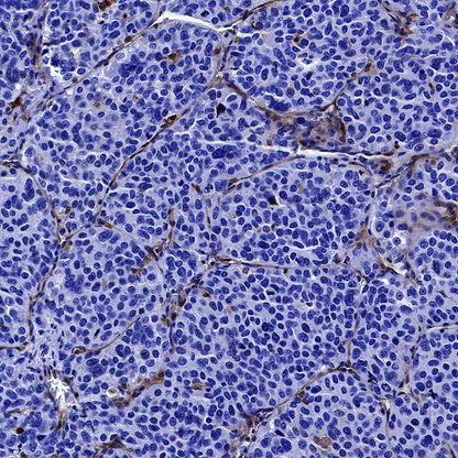 ADA Recombinant Rabbit mAb (S-5470)