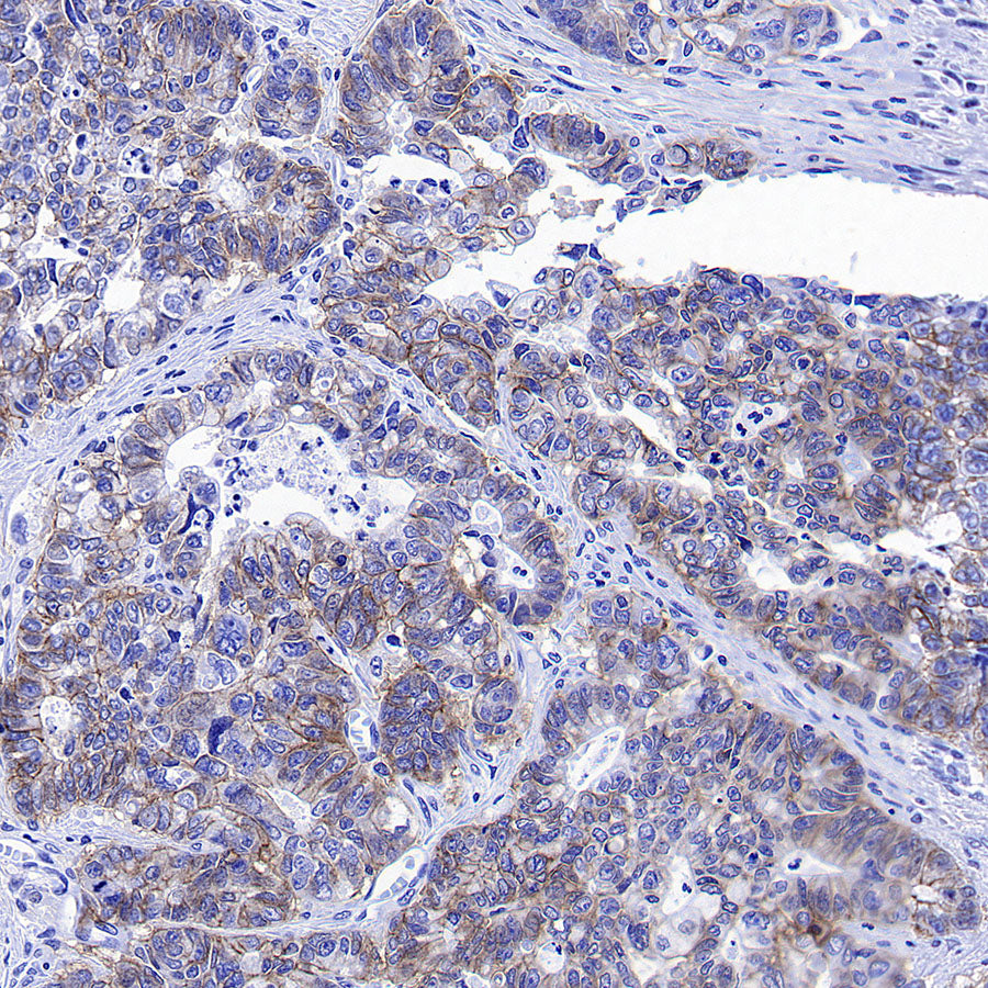 CDCP1 Recombinant Rabbit mAb (S-3437-221)