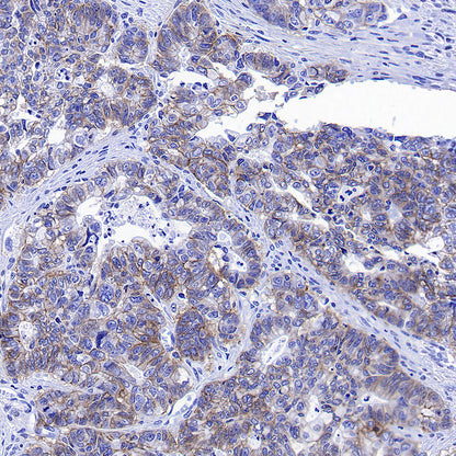 CDCP1 Recombinant Rabbit mAb (S-3437-221)