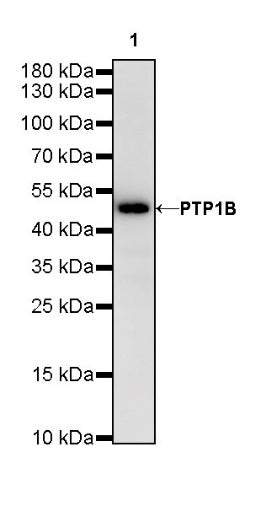 PTP1B Recombinant Rabbit mAb (S-R304)