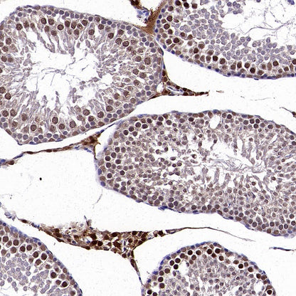 DNA Ligase IV/LIG4 Recombinant Rabbit mAb (S-2237-64)