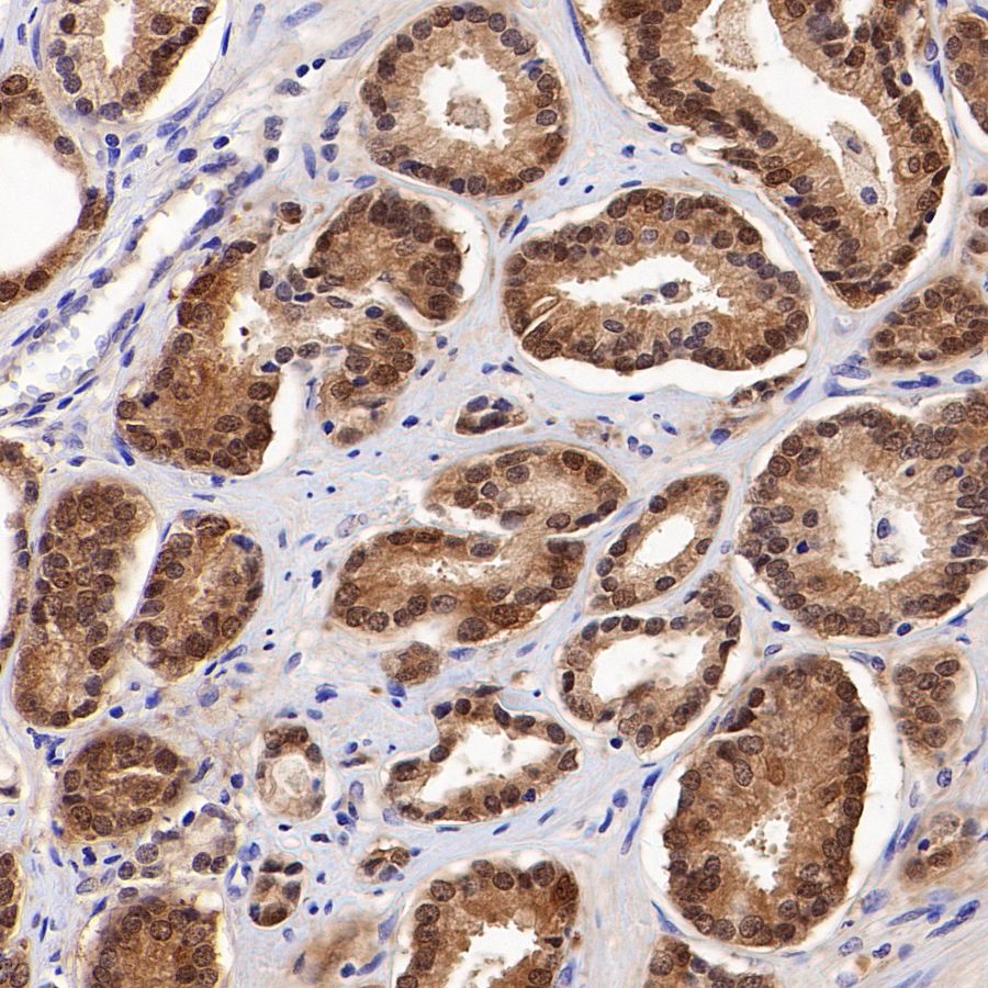 4E-BP1 Recombinant Rabbit mAb (S-1654-47)