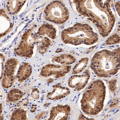 4E-BP1 Recombinant Rabbit mAb (S-1654-47)