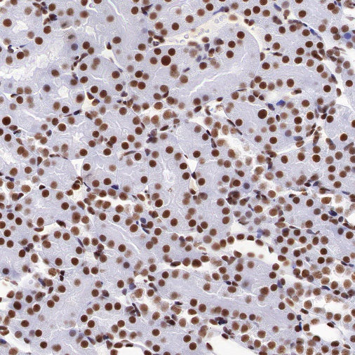 PIAS1 Recombinant Rabbit mAb (S-1430-7)