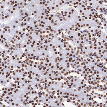 PIAS1 Recombinant Rabbit mAb (S-1430-7)