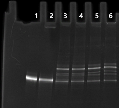 T4 RNA Ligase 1