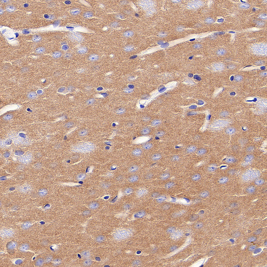 AP-2α Recombinant Rabbit mAb (S-4444-44)